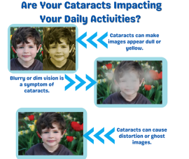 Are Your Cataracts Impacting Your Daily Activities?